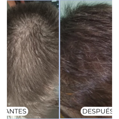 Alma Secret - Reinigungsshampoo Shikakai für normales oder fettiges Haar