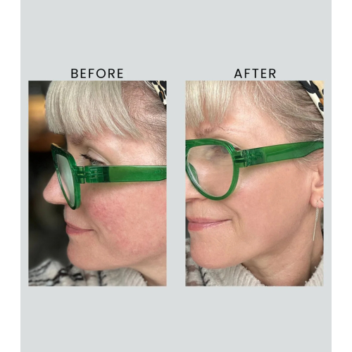 Altruist - Tagescreme Dermatologist Anti-Redness & Pigmentation Light SPF50