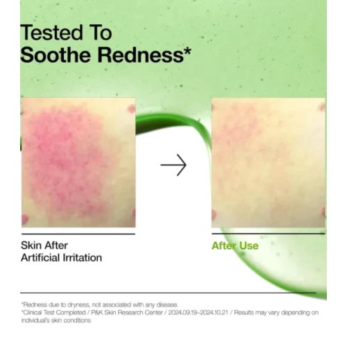 Anua - Anti-Akne-Serum mit 10+ Azelainsäure und Hyaluronsäure