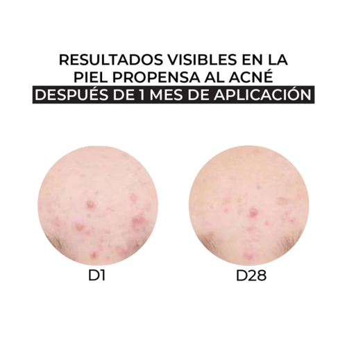 Arganour - Feuchtigkeitscreme-Kombination und fettige Haut