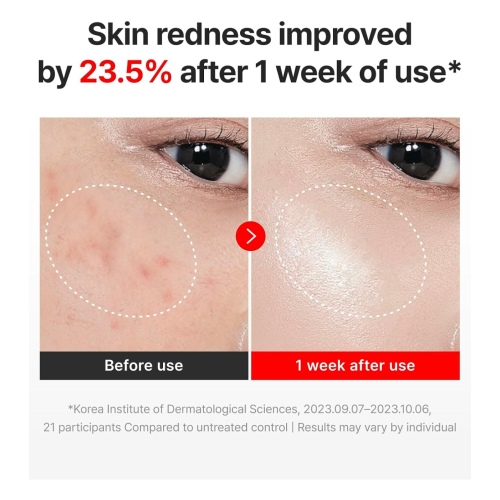 Centellian24 - Anti-Aging-Creme Time Reverse