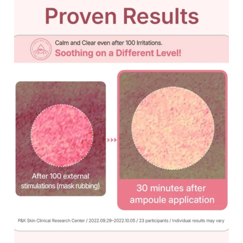 Centellian24 - *Daily Repair* - Gesichtsserum für empfindliche Haut Total Care Solution