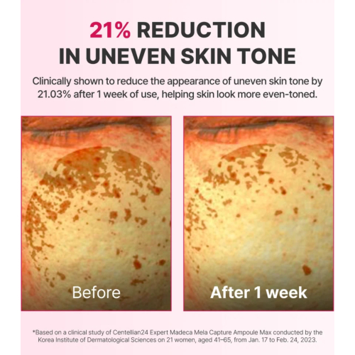 Centellian24 - Serum gegen Flecken Expert Madeca Mela Capture