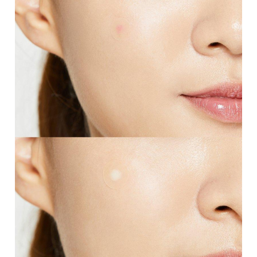 COSRX - Flecken gegen Hautunreinheiten Acne Pimple Master Patch