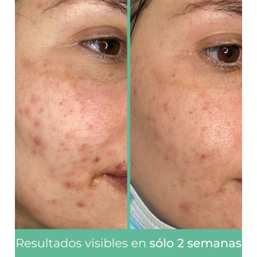 CR Cosmetics - *Purifying* - Talgregulierende Gesichtscreme