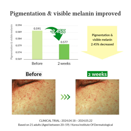 Dr. Althea - Depigmentierendes Serum Gentle Vitamin C