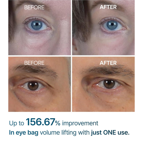 Dr.Melaxin - Creme gegen Augenringe Eyephalt