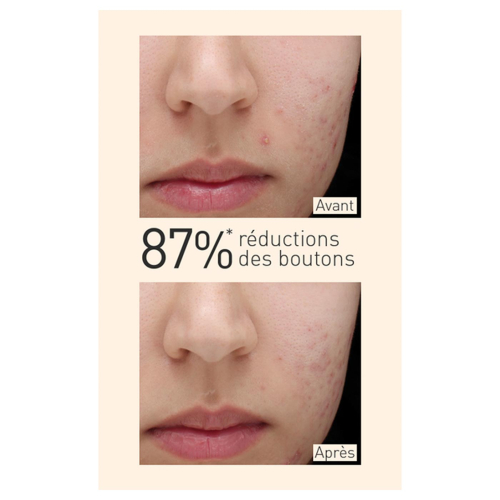 Embryolisse – Mattierendes Serum für Mischhaut bis fettige Haut mit Kurkuma-Extrakt