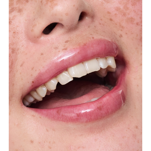 essence - Lippenbehandlung Juicy Serum - 01: Raspberry