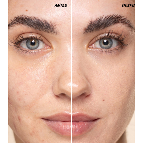 Freshly Cosmetics – Mehrzweck-Concealer Vitamin Fix – 300 Apricot Nectar