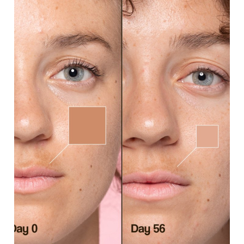 Freshly Cosmetics - Depigmentierende Gesichtscreme Lotus Radiance Dark Spot Treatment