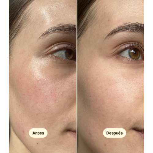 Freshly Cosmetics - Centella Asiatica Feuchtigkeitsspendende Tagescreme CICA Calm - Trockene und empfindliche Haut