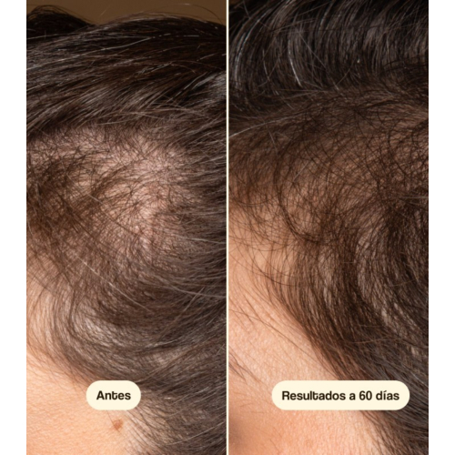 Freshly Cosmetics – Behandlung gegen Haarausfall Hair Growth & Density