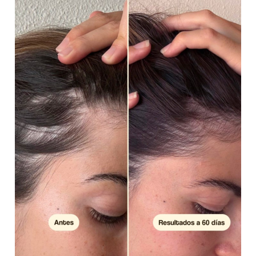 Freshly Cosmetics – Behandlung gegen Haarausfall Hair Growth & Density