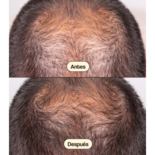 Freshly Cosmetics – Behandlung gegen Haarausfall Hair Growth & Density