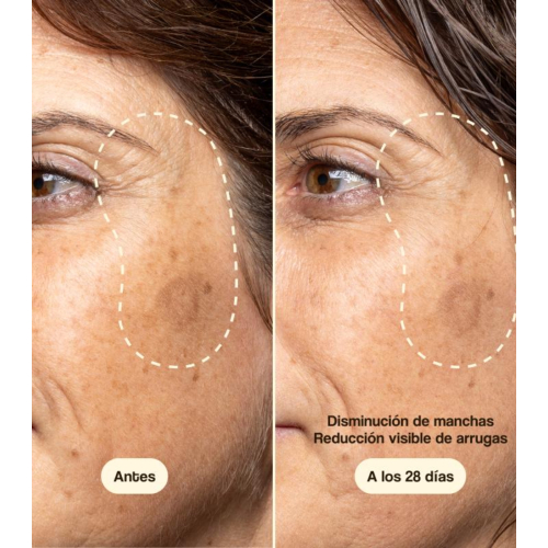 Freshly Cosmetics - Gesichtsbehandlung mit Vitamin C