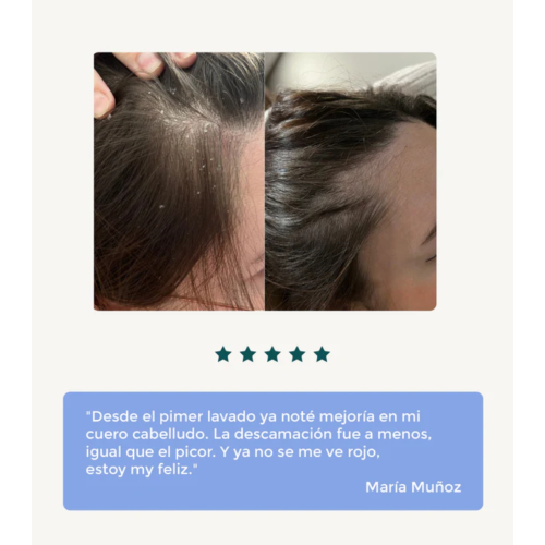 Green Cornerss - Erbsenshampoo - Empfindliche Kopfhaut