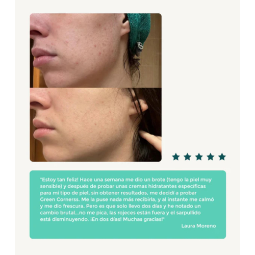 Green Cornerss - Feuchtigkeitsspendende Gesichtscreme mit Kohl - Atopische Haut