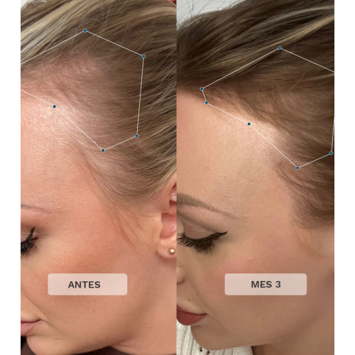 Hairburst - Haarvitamine Advance + Premium