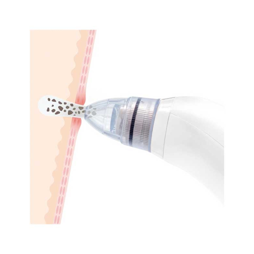 InnovaGoods - Elektrischer Gesichtsreiniger für Mitesser Pore·Off