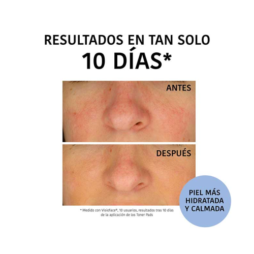 Iroha Nature  - Toning Discs - Feuchtigkeitsspendend und beruhigend