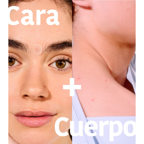 Iroha Nature - *Acne Prone Skin* - Pickelpflaster mit Salicylsäure Microdarts