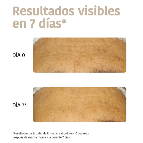 Iroha Nature - Anti-Falten- und Anti-Aging-Maske für Gesicht und Hals - Kollagen + Hyaluronsäure