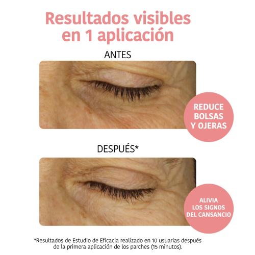 Iroha Nature – Anti-Müdigkeits- und Aufhellungspflaster – Vitamin C, Gurke und Hyaluronsäure