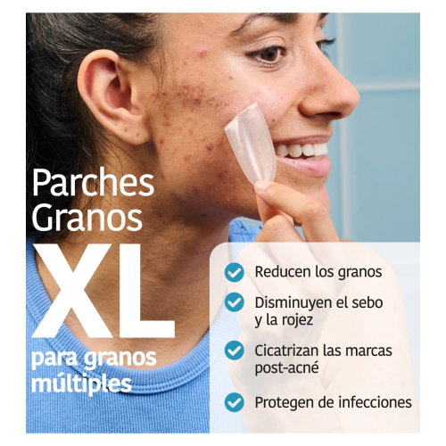 Iroha Nature - *Acne Prone Skin* - Pickelpflaster mit Salicylsäure XL