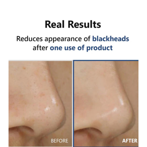 ISNtree – *Mugwort* – Tonisierendes Abendserum Hyper Acid 4 AHA BHA PHA LHA 30