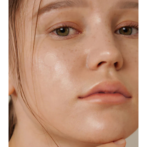 ISNtree - Anti-Pickel-Pflaster Onion Newpair Basic - 24 Einheiten