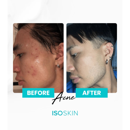 ISOCLEAN - *ISOSKIN* - Gesichts- und Körperspray Hypochlorous - 100 ml