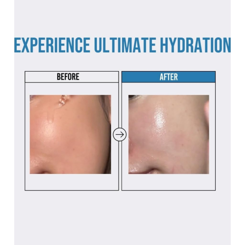 Jumiso - *Waterfull* - Feuchtigkeitsspendendes Gesichtsserum Hyaluronic Acid