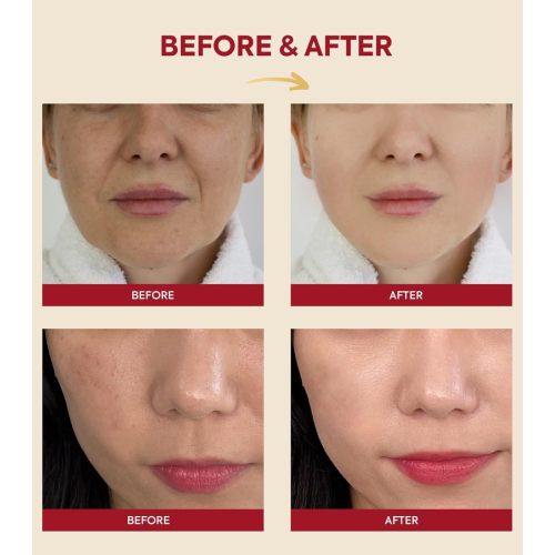 K-Secret - *Seoul 1988* - Essenz Snail Mucin 97% + Rice