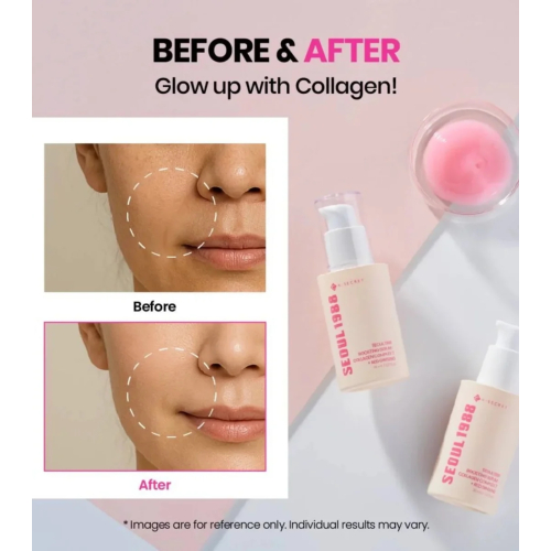 K-Secret - *Seoul 1988* - Serum Boosting Collagen Complex 7 + Red Ginseng