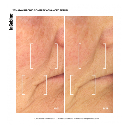 La Cabine - Fortschrittliches Serum 25% Hyaluronic Complex