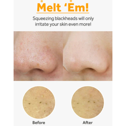 ma:nyo - *Pure & Deep* - Feuchtigkeitsspendendes Gesichtsreinigungsöl