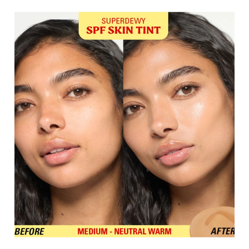 Makeup Revolution - Foundation Superdewy Skin Tint SPF30 - Medium Neutral Warm