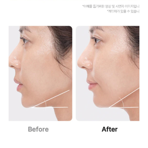 Medicube - *Age-R* - Fortschrittliches Gesichtspflegegerät Booster Pro Ex