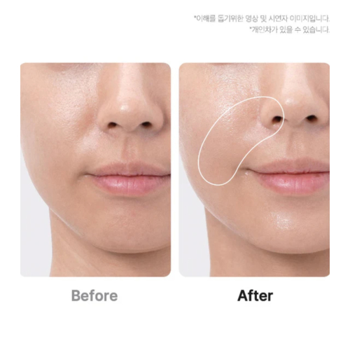 Medicube - *Age-R* - Fortschrittliches Gesichtspflegegerät Booster Pro Ex - Pink