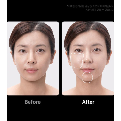 Medicube - *Age-R* - Fortschrittliches Gesichtspflegegerät Booster Pro Ex - Pink