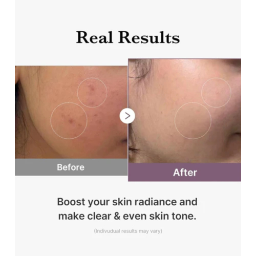 Medicube - *Age-R* - Feuchtigkeitsspendender Toner Glutathione Glow Toner