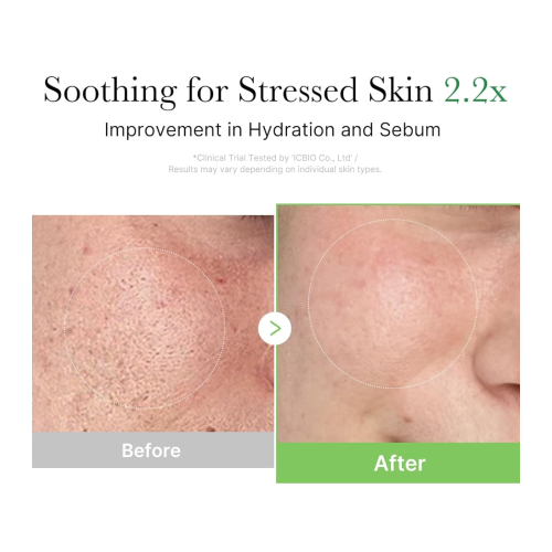 Medicube - *Cica* - Reparierende Gesichtscreme Exosome Cica Cream