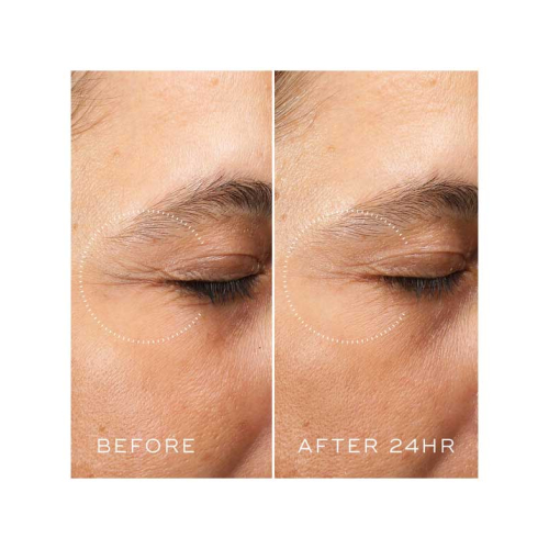 Medik8 - *Crystal Retinal* - Anti-Aging Augenkonturcreme mit Retinal und Vitamin A Ceramide Eye 6