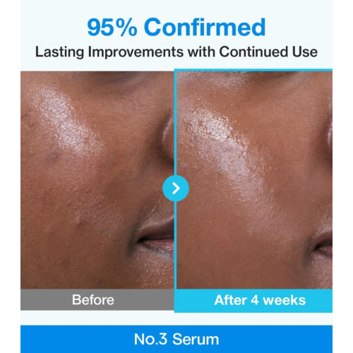 Numbuzin - Porenverfeinerndes Serum No.3 Blue Bio-Retinol