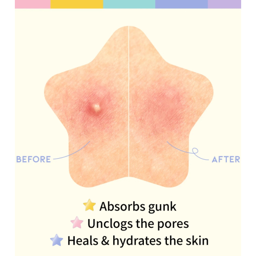 OOTD Beauty - Sternflecken-Patch Star Spot Patch