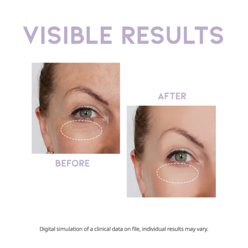 OOTD Beauty - Augenserum für die Nacht