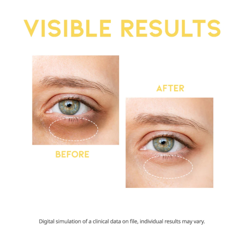 OOTD Beauty - Aufhellendes Augenserum Dark Circle