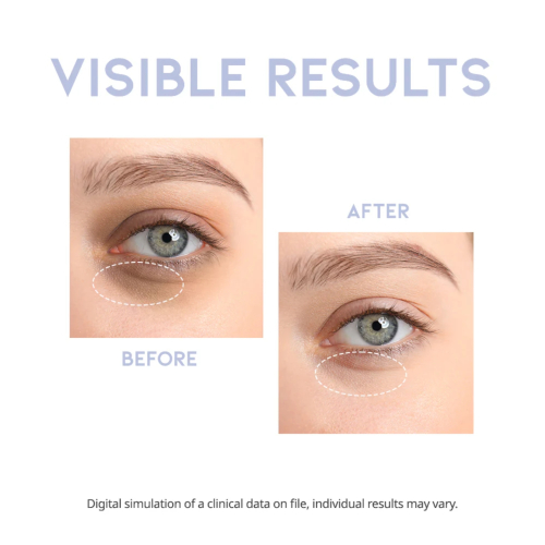 OOTD Beauty - Revitalisierendes Augenkonturserum Intensive Serum