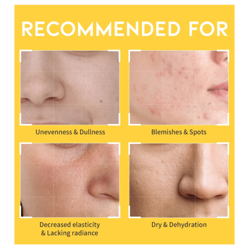 OOTD Beauty - Dark Spot Vitamin C Aufhellender Toner